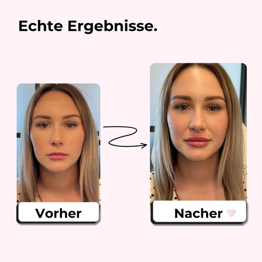 GlowLips Lip Boost Set